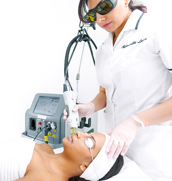 Laser Hair Removal