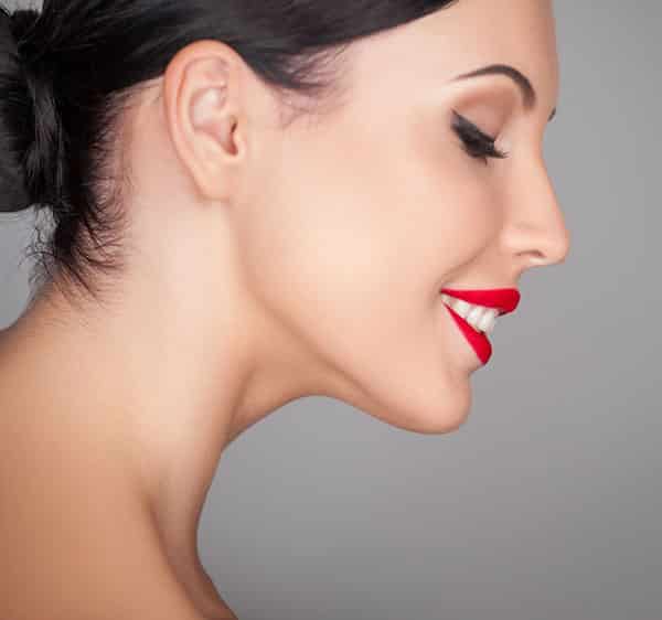 Kybella