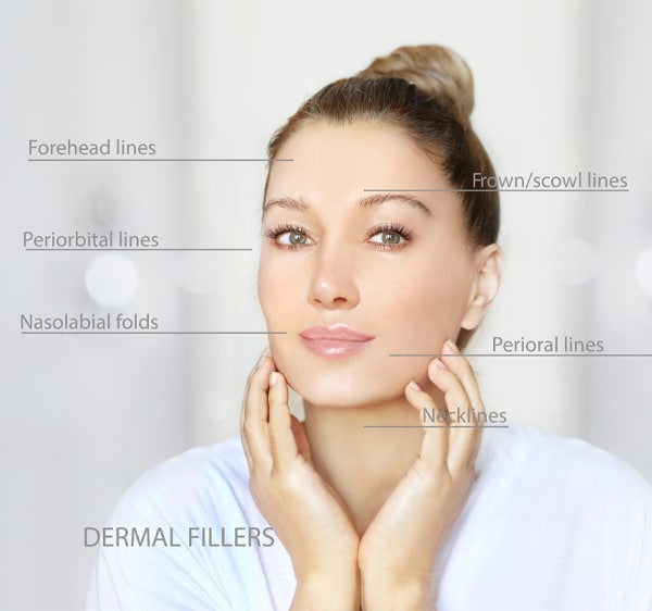 Restylane