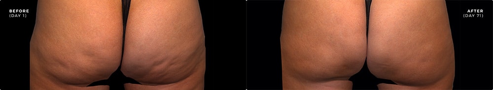 QWO Before & After