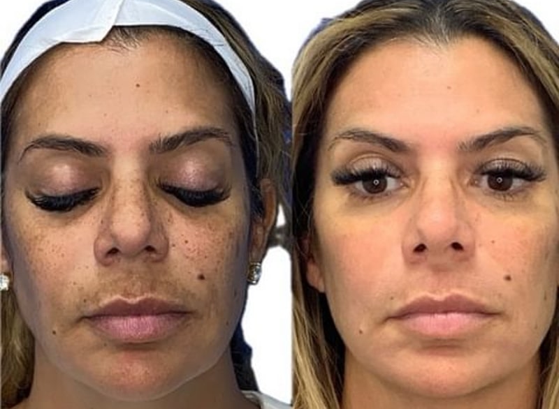 MOXI Before and After Boston and Waltham