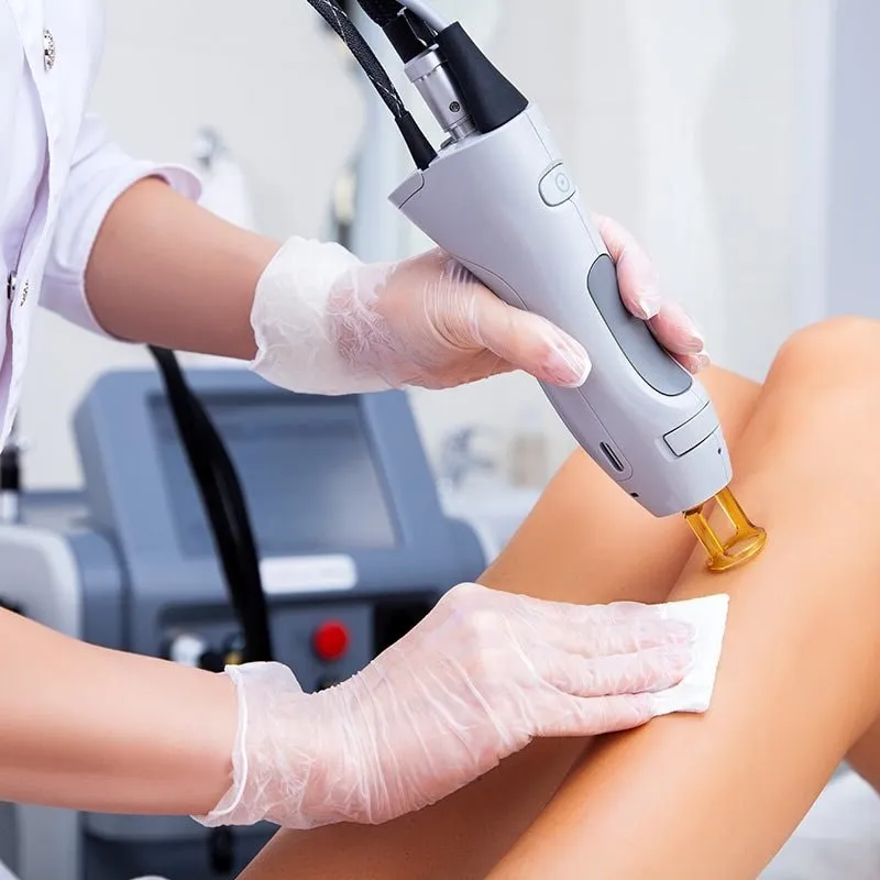 A woman receiving laser treatment on her legs.