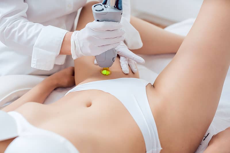 A woman receiving laser hair removal treatment.