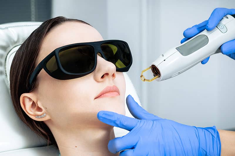 A woman receiving laser treatment on her face.