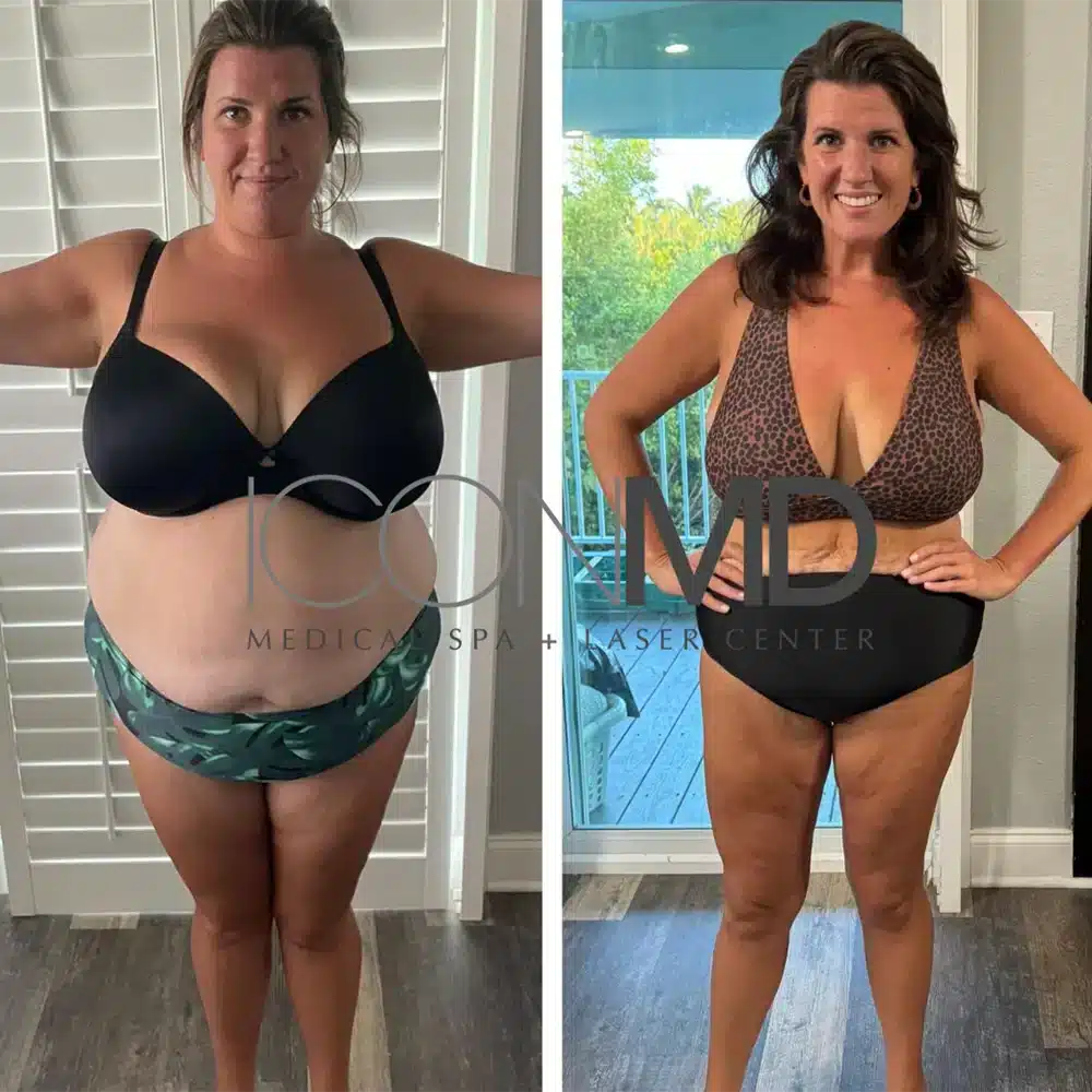 weight loss medication before and after